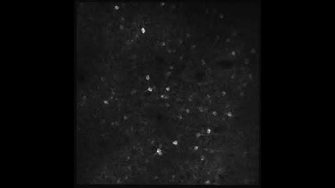 Activity of a cortical neuronal population visualized by two-photon calcium imaging