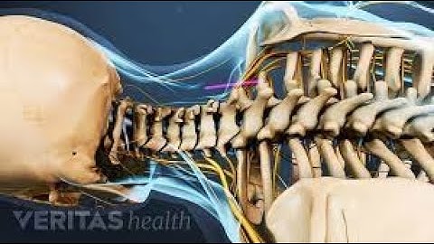 Vertebral corpectomy with Decompression CPT code - simplify medical coding