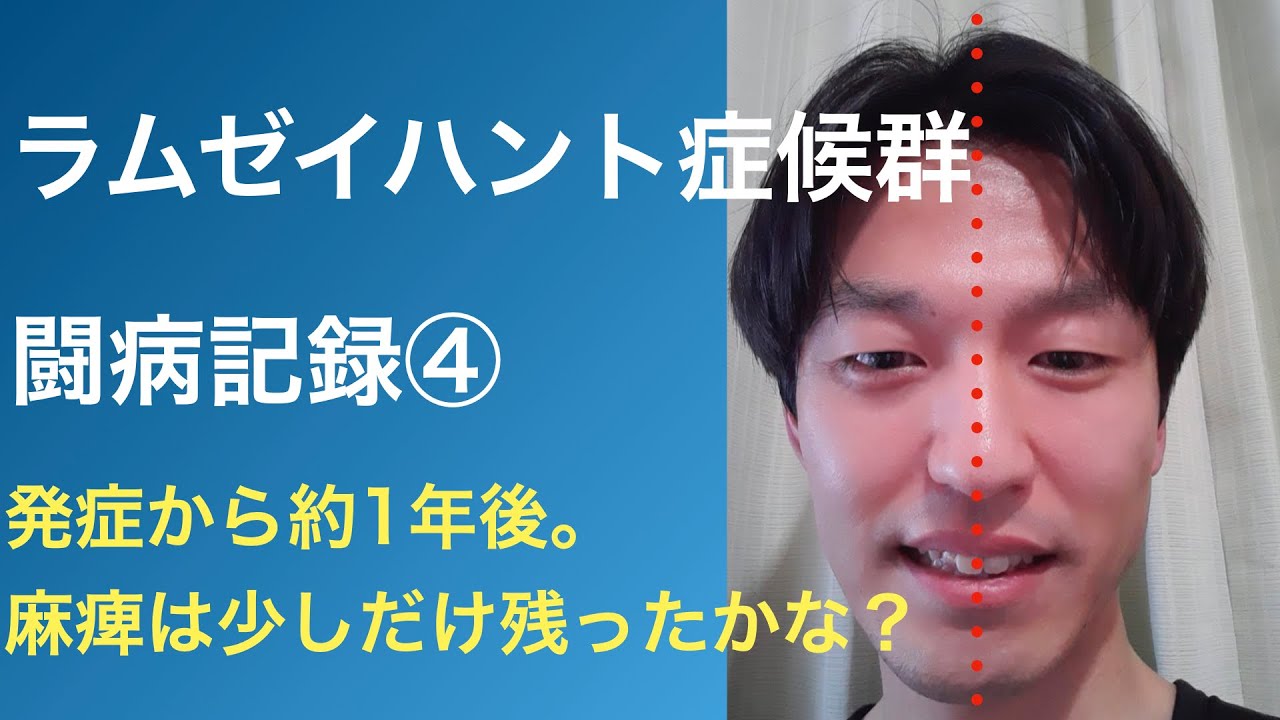ラムゼイ ハント 症候群