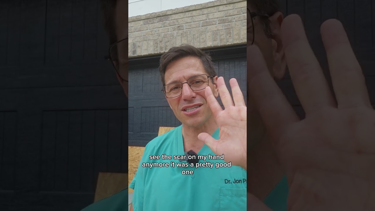 A hand laceration from a shop tool can happen fast