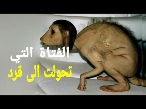 الفتاة الممسوخة التي تحولت الى قرد القصة التي ارعبت العالم العربي سنة 2005