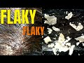 BIG FLAKES - Scalp Psoriasis Removal