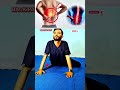 #BackPainRelief #youtubeshorts #StretchForHealth #ViralWorkout #trending #foyoupage #growmyaccoun✅