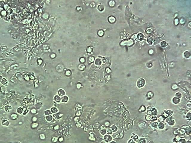 Trichomonas abból amit elvesznek orsóféreg ember