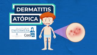 Cuidados en dermatitis atópica