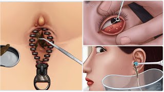 ASMR | zipper Navel Stone Remove Animation