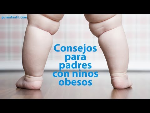 cuales son los sintomas de sobrepeso