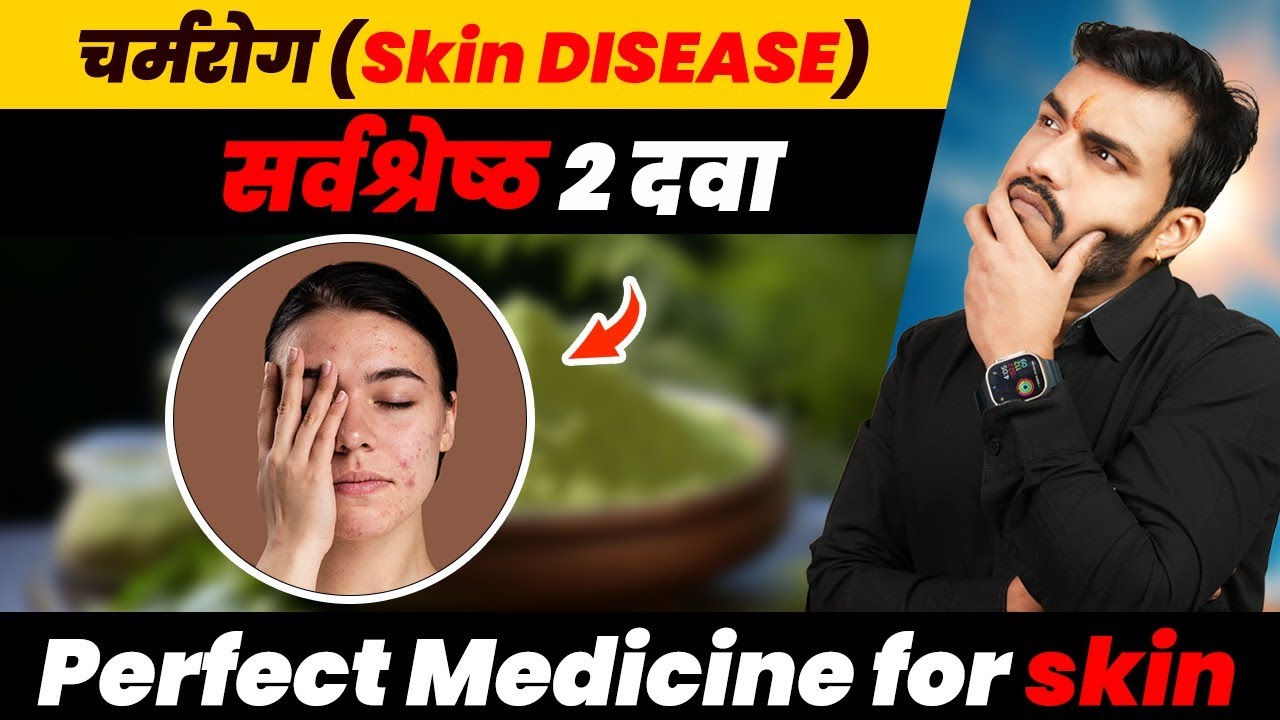 चर्मरोग(Skin Disease) 2 Perfect दवा।। ख़ाना,पीना,नहाना,धोना सब में use करना Ep.603