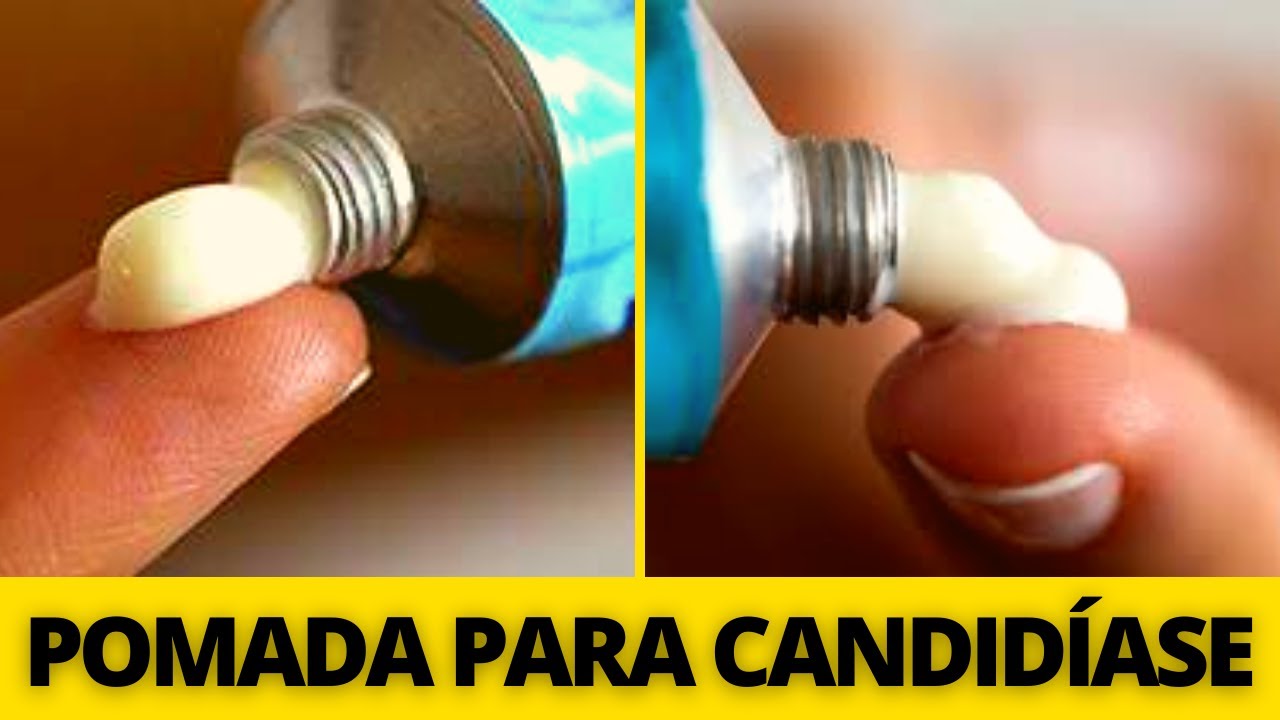 As 5 melhores POMADA PARA CANDIDÍASE que você usar ainda hoje! - YouTube