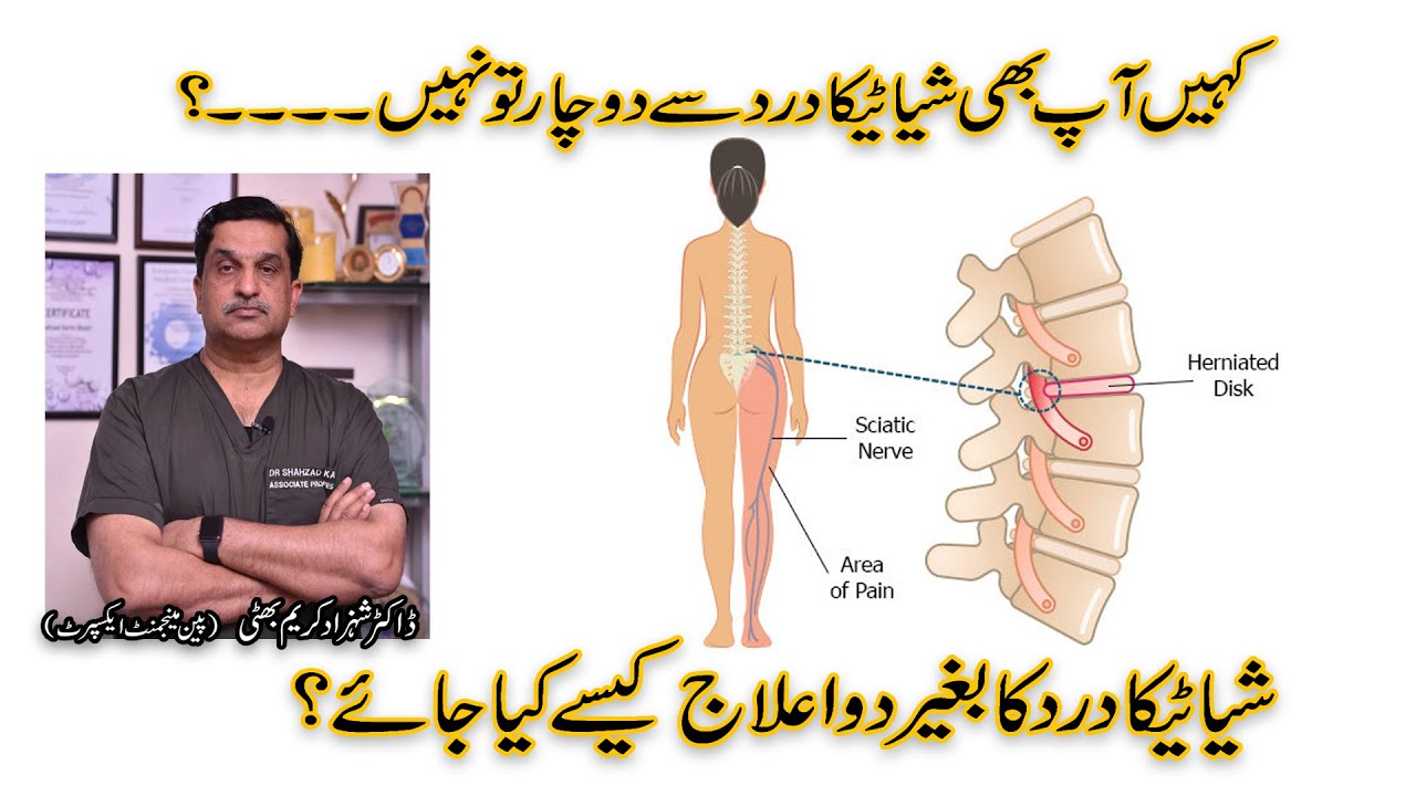 How to Relieve Sciatic Nerve Pain | Treatment of Sciatica |    Dr. Shahzad Karim Bhatti