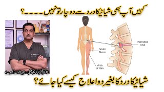 How To Relieve Sciatic Nerve Pain Treatment Of Sciatica Dr. Shahzad Karim Bhatti