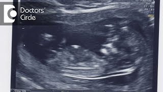 What is a normal nuchal translucency measurement?-Dr. Geeta Komar