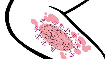 A Pathway-Based Approach