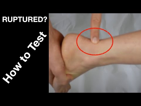 How to test for Achilles tendon rupture and other conditions.