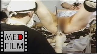 Гинекология: эндоскоп, лапароскоп, рентген © Gynecology: endoscope, laparoscope, X-reys Гинекология: эндоскоп, лапароскоп, рентген © Gynecology: endoscope, laparoscope, X-reys