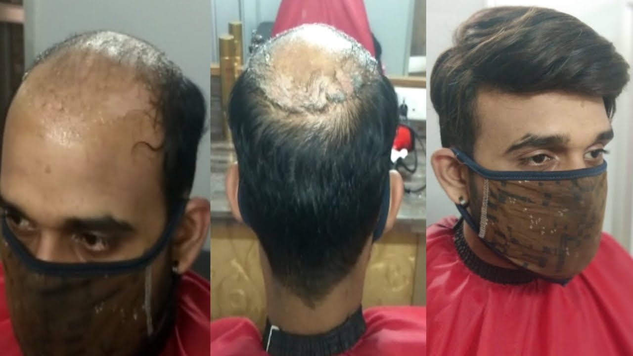 How to use hair wig hair patch Hair Bonding shop in Nagpur call