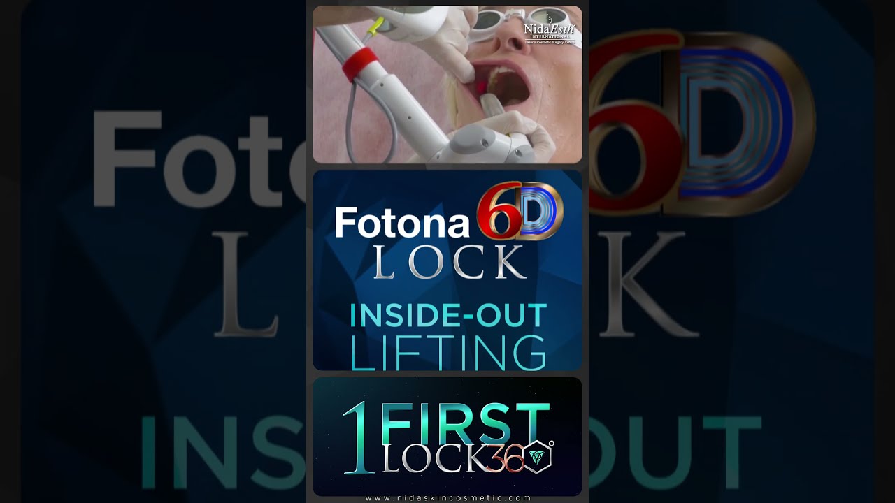 🎄✨ 𝐘-𝐋𝐎𝐂𝐊 𝟑𝟔𝟎°: 𝐑𝐞𝐝𝐞𝐟𝐢𝐧𝐢𝐧𝐠 𝐀𝐞𝐬𝐭𝐡𝐞𝐭𝐢𝐜𝐬 𝐁𝐞𝐲𝐨𝐧𝐝 𝐁𝐨𝐫𝐝𝐞𝐫𝐬! ✨🎄