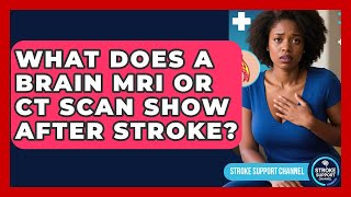 What Does A Brain MRI Or CT Scan Show After Stroke? - Stroke Support Channel