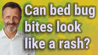 Can bed bug bites look like a rash?