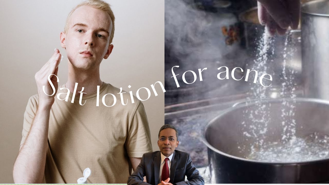 Salt lotion - a natural remedy for acne - YouTube