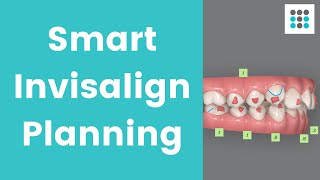 SMART INVISALIGN PLANNING REDUCES TREATMENT TIME: Patient Case Study l Dr. Bailey