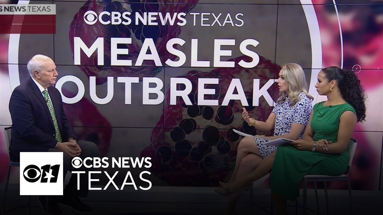 What you need to know about the measles as more cases confirmed in