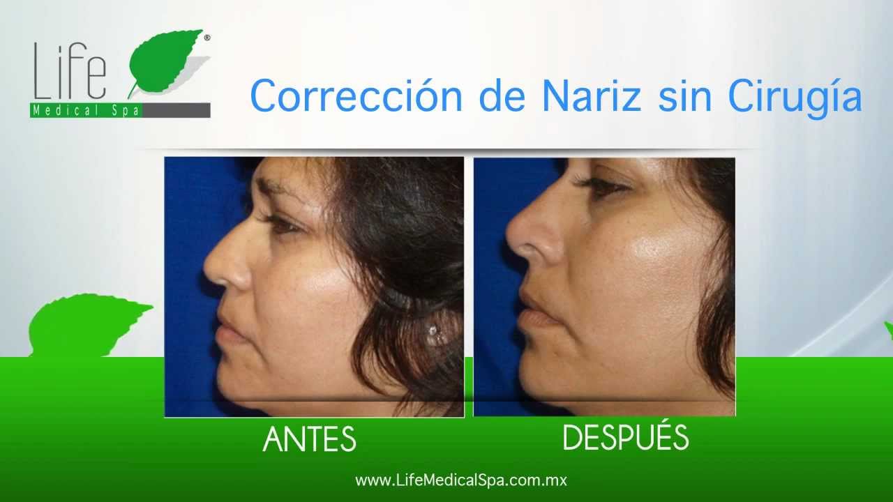 SPA EN GUADALAJARA LIFE MEDICAL SPA 10 DE DESCUENTO! YouTube