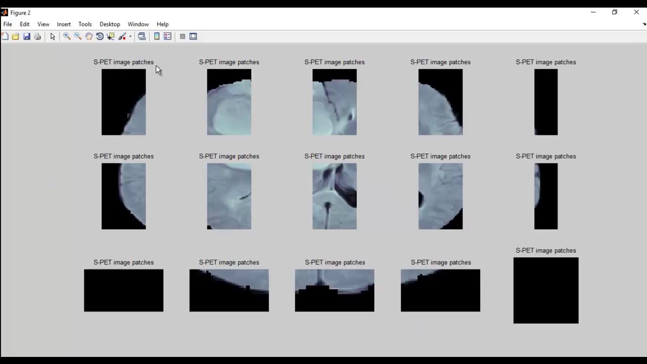 PET and Multimodal MRI image matlab projects - YouTube