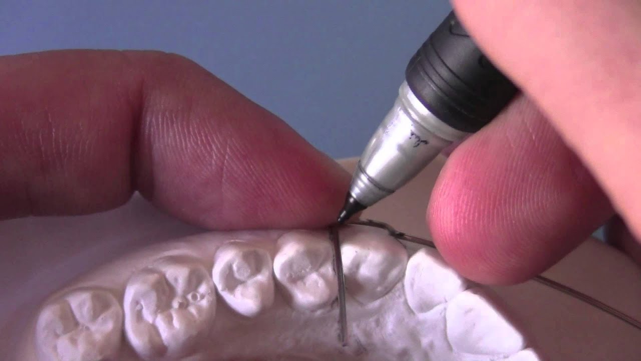 Confecção do Arco Hawley UNIP