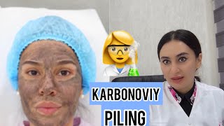 VLOG#7 KARBONOVIY PILING HAQIDA KOSMETOLOG MASLAHATI ✅