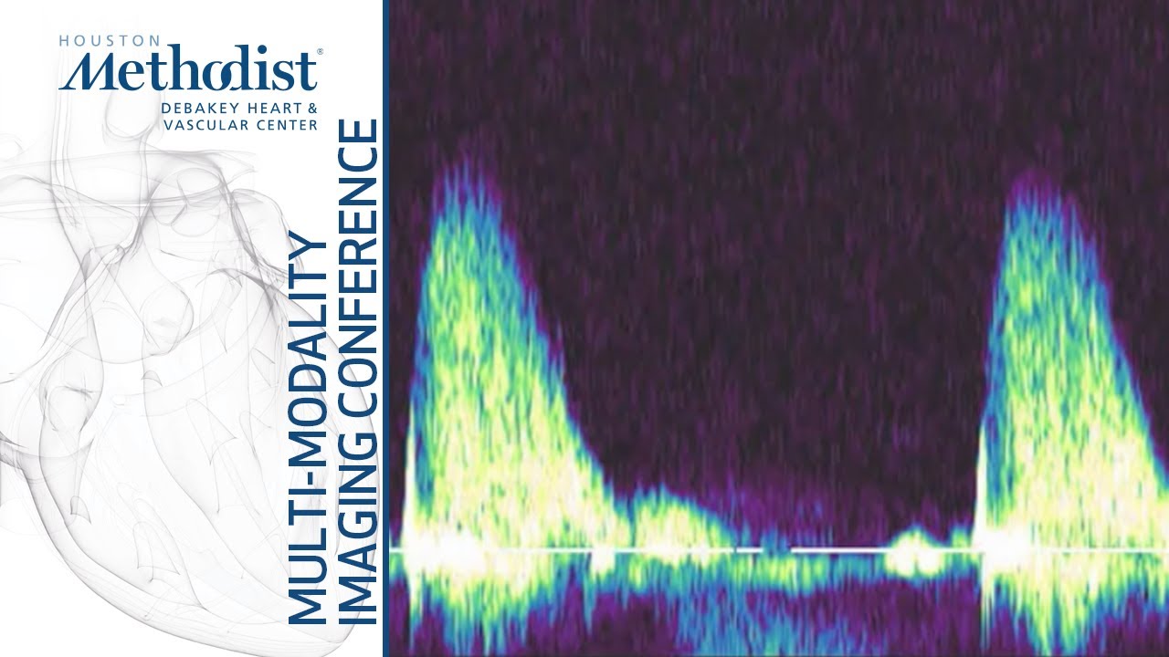 Echo Assessment of Hemodynamics (Sherif F. Nagueh, MD) October 19, 2021