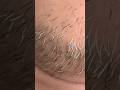 Let's Pluck #beardcare #plucking #facehair #hair