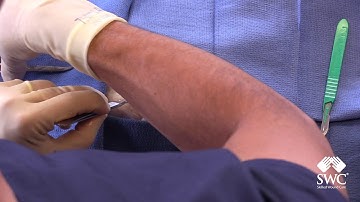 Incision and Drainage of Abscess