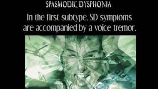 Spasmodic Dysphonia, The Unknown Silencer