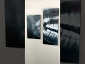 Cuadro de Pared, Tema &quot;Radiografia&quot; Decoración para consultorio de Dentistas 150x80cm
