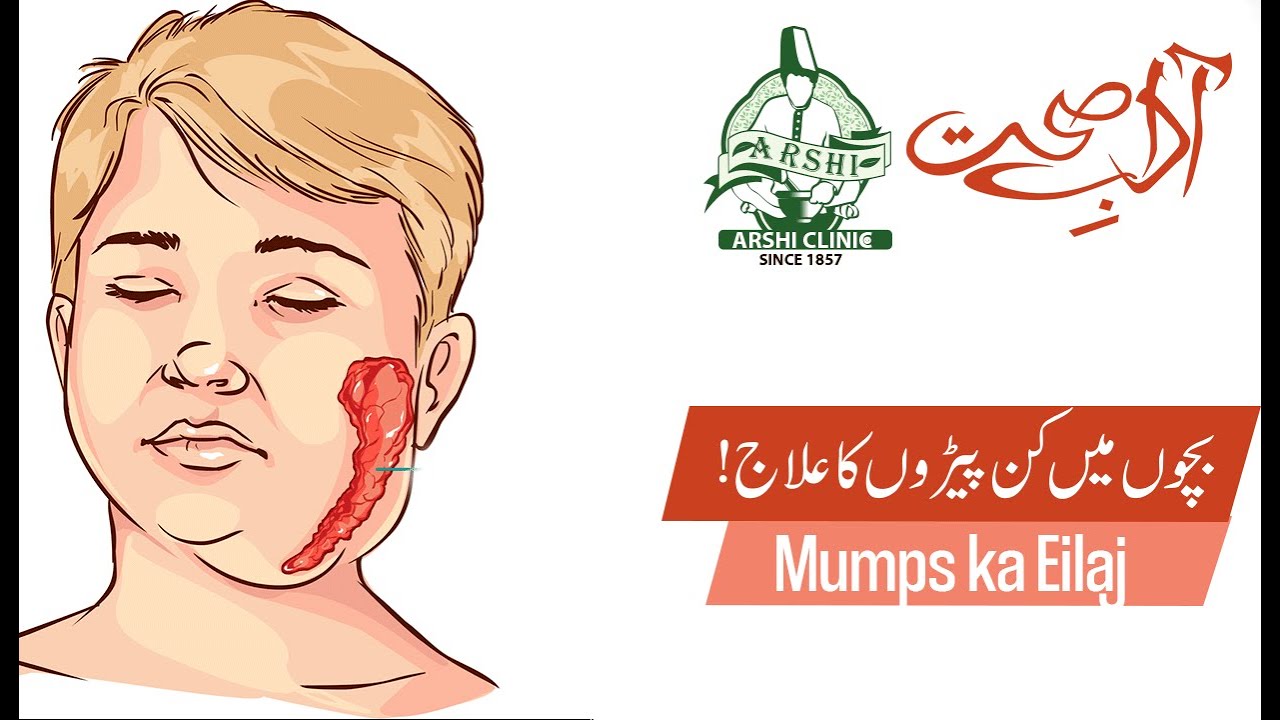 Bachon my Kan Perry/Mumps ki Ilamat wajohat or Ilaj in Urdu/Hindi YouTube