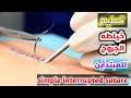 تعليم خياطه الغرز للمبتدأين في ١٠ دقائق_Teaching stitching wounds for beginners in 10 minutes