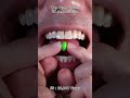 Satisfying Chewing ASMR #Compilation #ASMR #DoctorTristanPeh
