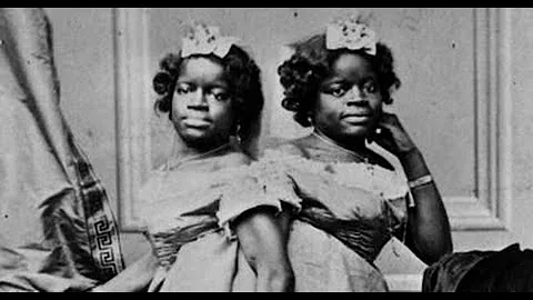 IN MEMORY OF MILLIE & CHRISTINE (THE TWO HEADED NI...