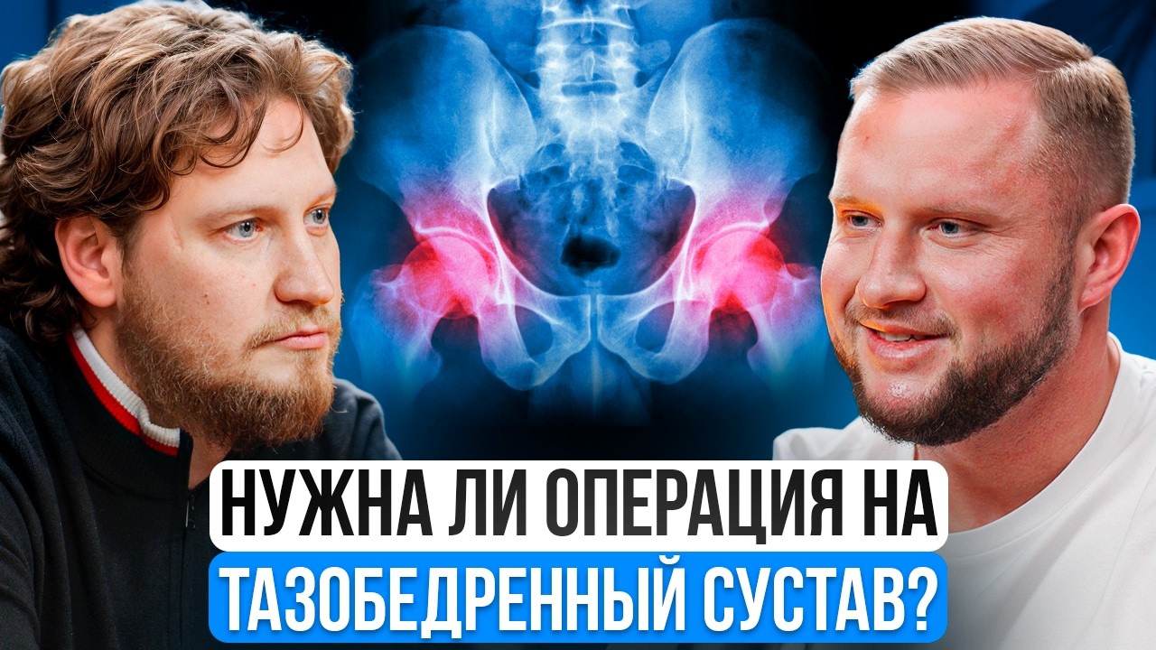 Вся правда об ЭНДОПРОТЕЗИРОВАНИИ Тазобедренного сустава - Подкаст с Врачом травматологом!
