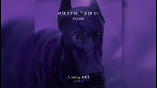 Madonna Vs Sickick - Frozen [Fireboy DML Remix] (Official Audio)
