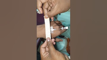 IV Cannulation technique video#mbbs #viralvideo