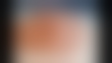 The modified Mercedes flap. #126