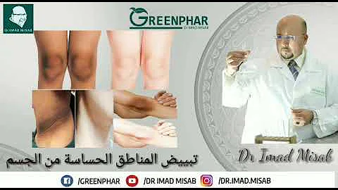 تبييض المناطق الحساسة من الجسم وصفة جد فعالة للدكتور عماد ميزاب Dr Imad Misab 