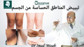 تبييض المناطق الحساسة من الجسم وصفة جد فعالة للدكتور عماد ميزاب Dr Imad Misab