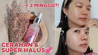 REVIEW PONDS FLAWLESS WHITE BISA UNTUK KULIT BERJERAWAT DAN BERMINYAK