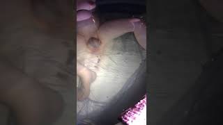 HBA2C(homebirth after 2 cesareans), waterbirth, natural birth