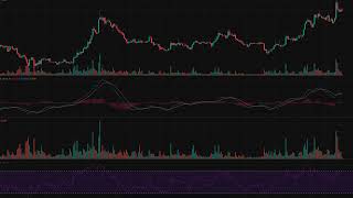 Adausdt 4-Hour Technical Analysis Cardano At 0.2007 Cil Signal Ai