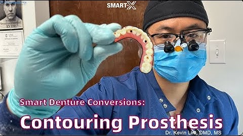 How to create Smart Denture Conversions screw access hole and AOX Prothesis Contouring