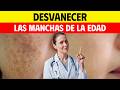 Las manchas de la edad NO son un signo normal del envejecimiento